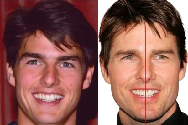 Tom Cruise Teeth