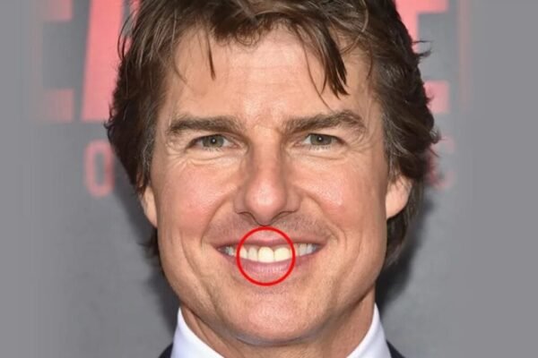 Tom Cruise Teeth Before and After