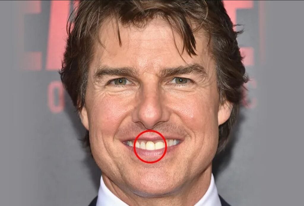 tom cruise middle tooth tom cruise middle tooth